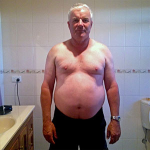 man with shirt off before weight loss
